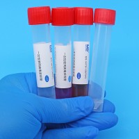 一次性使用病毒采样管(灭活型)(非灭活型)