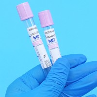 紫色管帽含EDTA-K2/EDTA-K3抗凝剂PET材质真空采血管_抽血管_血常规管