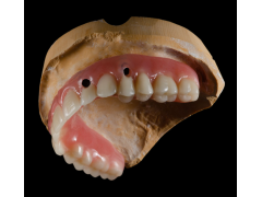 义齿工厂 假牙厂家 假牙出口 种植牙工厂图3