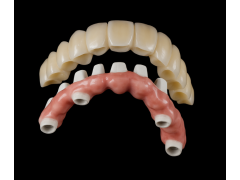 义齿工厂 假牙厂家 假牙出口 种植牙工厂图2