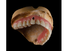 义齿工厂 假牙厂家 假牙出口 种植牙工厂图4