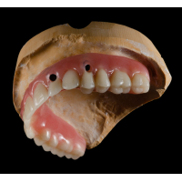深圳高端种植牙工厂 义齿外贸定制服务 外贸出口